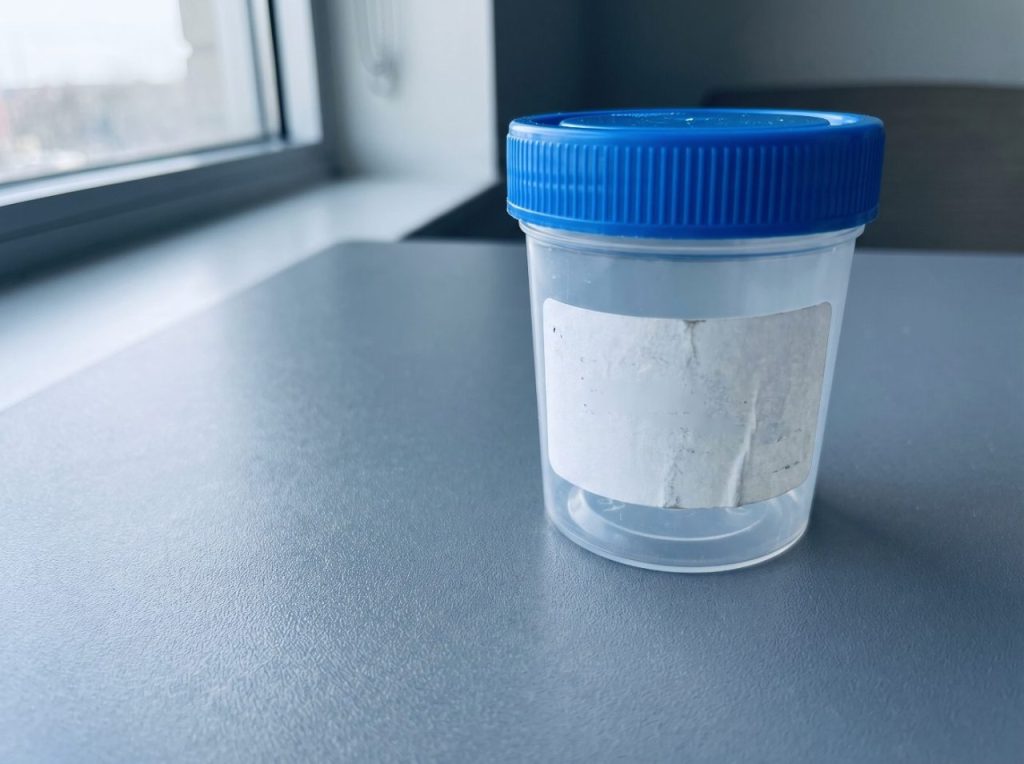 Sealed specimen cup for EtG alcohol testing